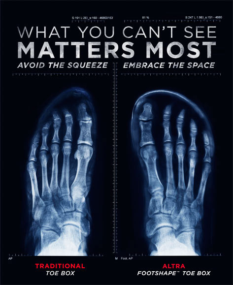 foot shape